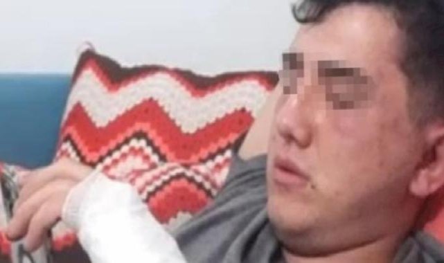 Çankırı'da sevgilisinden ayrılmak isteyen gence öldüresiye dayak