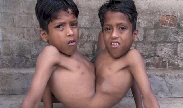 Dünyanın en ilginç hastalıkları