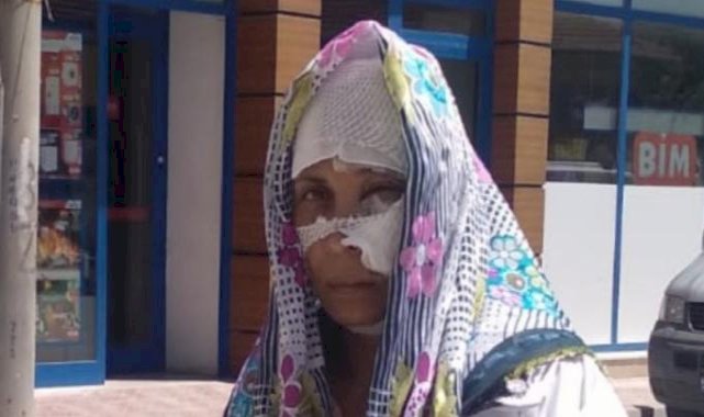 Eskişehir'de BİM'den lavabo açıcı alan kadın kabusu yaşadı