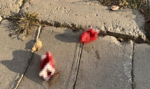 Tekirdağ'da cinnet geçiren genç, annesini öldürerek 4 kişiyi de yaraladı