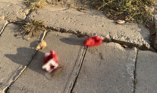 Tekirdağ'da cinnet geçiren genç, annesini öldürerek 4 kişiyi de yaraladı