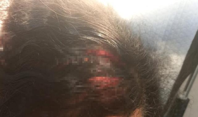 Ankara'da komşusunun arkadaşlık istediğini reddeden kadının hayatı kabusa döndü