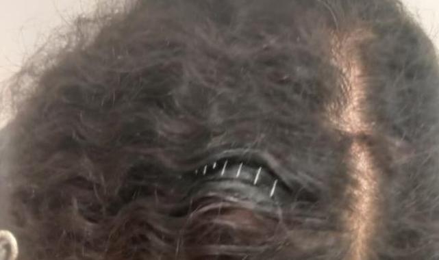 Ankara'da komşusunun arkadaşlık istediğini reddeden kadının hayatı kabusa döndü