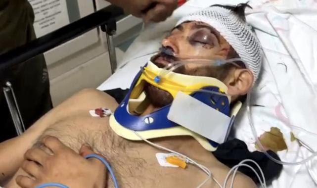 Antalya'da yumruk darbesiyle ölen çiçekçinin ölüm nedeni belli oldu