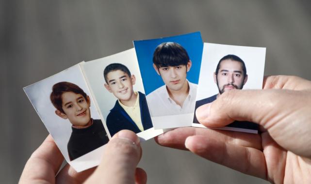 Antalya'da yüzündeki tümör yalnızlığa itti