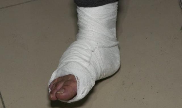 İstanbul'da rögar kapağı yüzünden otobüsten düşmüştü: Yaşadıklarını anlattı