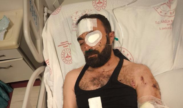 Mardin'de silahlı saldırıya uğradı: Daha önce kuzenimi öldürüp, beni bıçakladılar