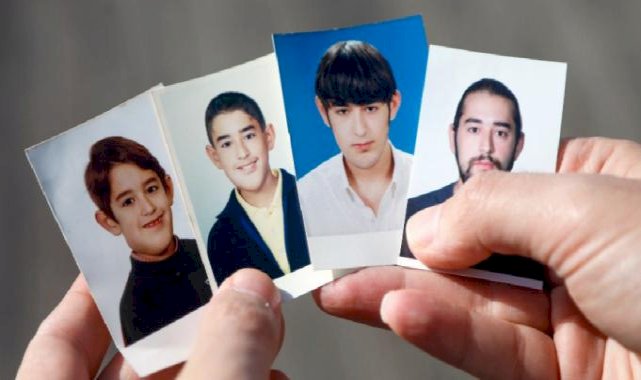 Antalya'da yüzündeki tümör yalnızlığa itti