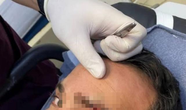 Aksaray'da imam kendisine saldıran komşusunu bıçakladı