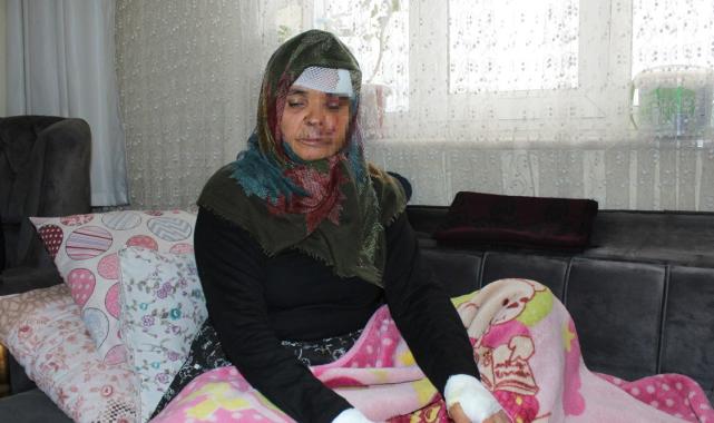 Aksaray'da yaşlı çift, kızlarının köpeğinin saldırısına uğradı