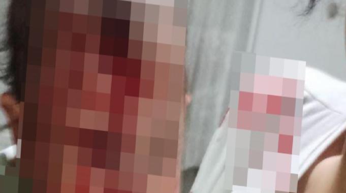 Ankara'da 4 aylık bebeğini cam sehpaya fırlatıp yaraladı