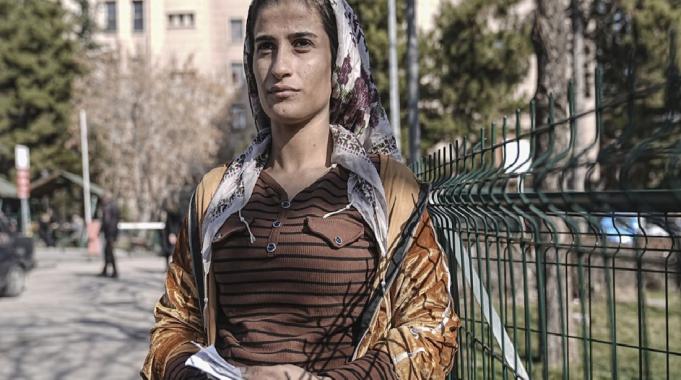 Ankara&#039;da sahipsiz köpeklerin saldırdığı kadın konuştu