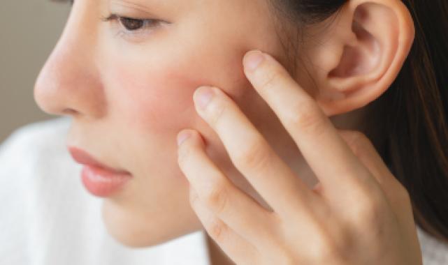 Cilt kuruluğu deyip geçmeyin!