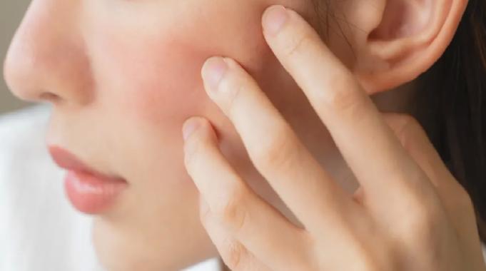 Cilt kuruluğu deyip geçmeyin!