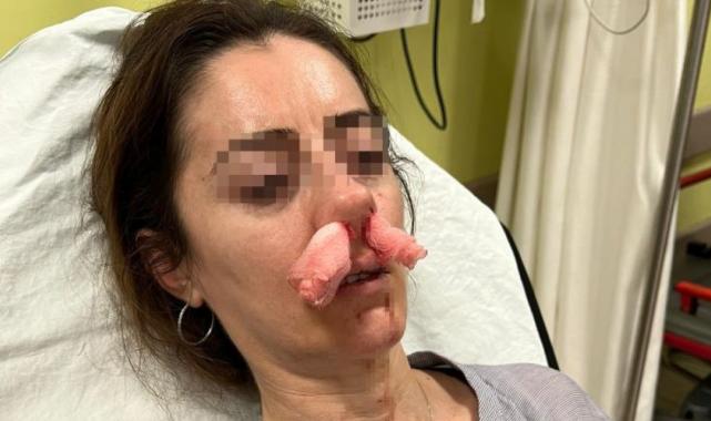 Edirne'de şaşkına çeviren olay: Kocasının sevgilisine benzettiği kadını darbetti