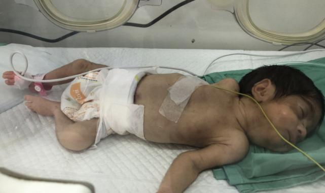 İsrail saldırısı altında olan Gazze'de oksijen sıkıntısı: Hasta bebeklerin hayatı tehlikede