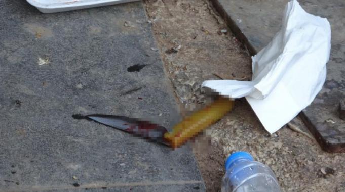 Mersin'de bıçaklı kavgada 2 kişi yaralandı