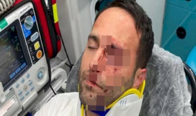 Aksaray'da darbettiği imamı telle boğmaya çalıştı