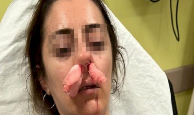 Edirne'de şaşkına çeviren olay: Kocasının sevgilisine benzettiği kadını darbetti