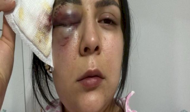 Kahramanmaraş'ta yürürken saldırıya uğrayan genç kız konuştu