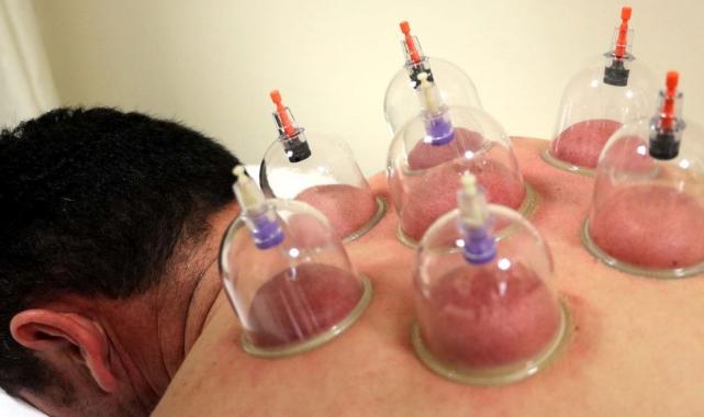 Yeni hacamat takvimi 2025: Ocak'ta hangi günler sünnettir