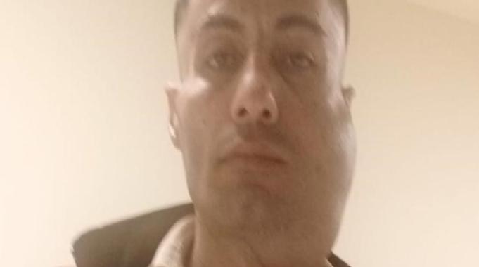 18 santimetrelik tümöründen kurtuldu: Artık yeni bir yüzü var