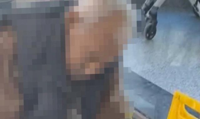 Aydın'da taburcu edilen hastanın ölü olduğu ortaya çıktı