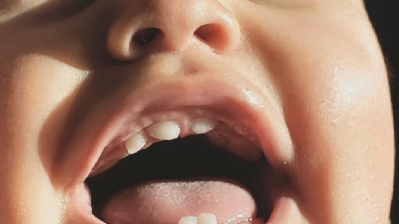 Bebeklikte ağız bakımıyla ömür boyu sağlıklı dişlere!