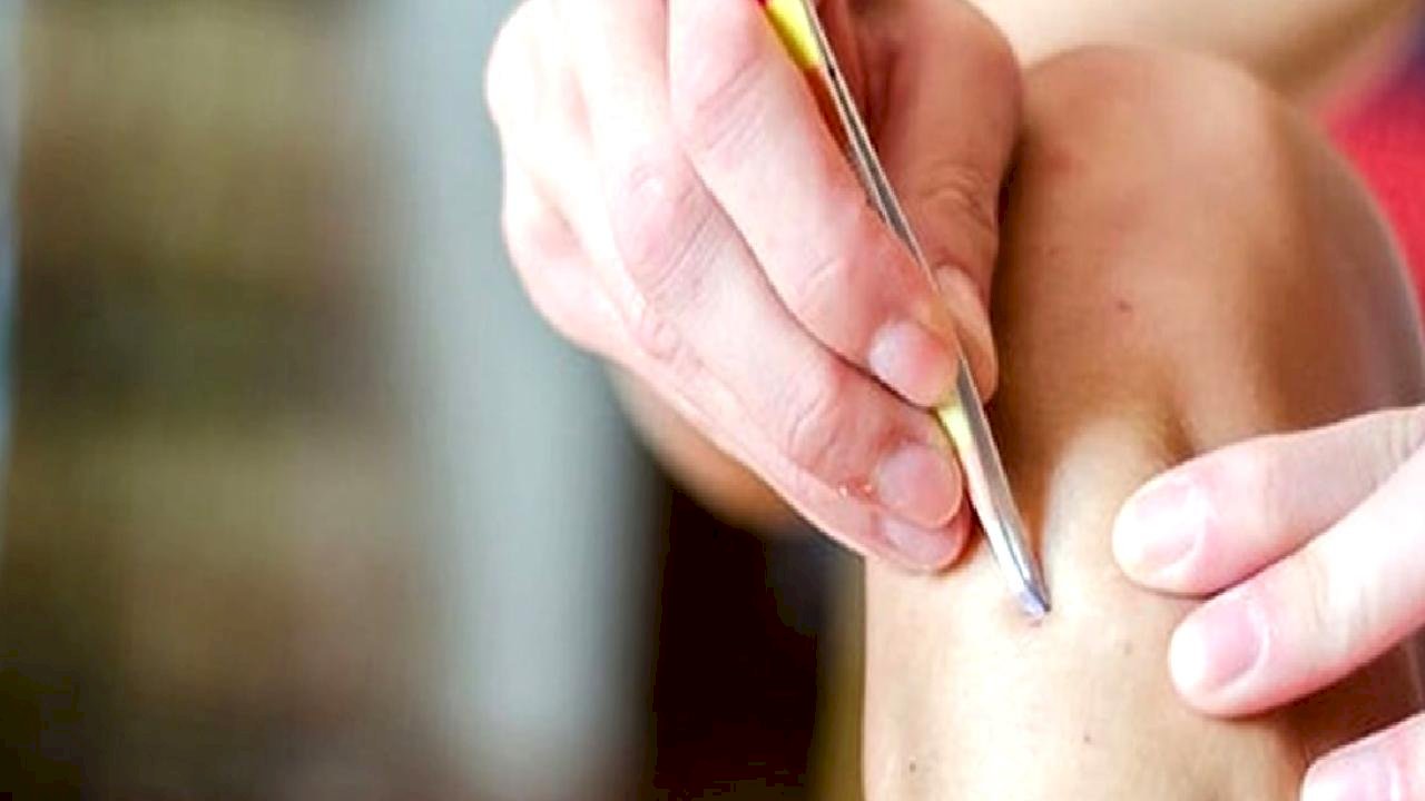 Jilet ve Peelinge Veda: Bu Tuz Batık Kılları Söküp Atıyor!