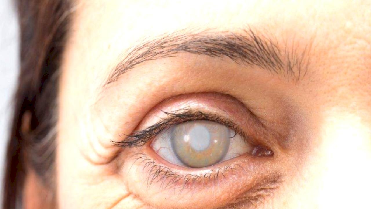 Tavuk Karası Hastalığı Tedavisi