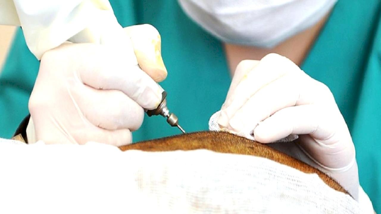 Türkiye, sağlık turizmi için tercih ediliyor