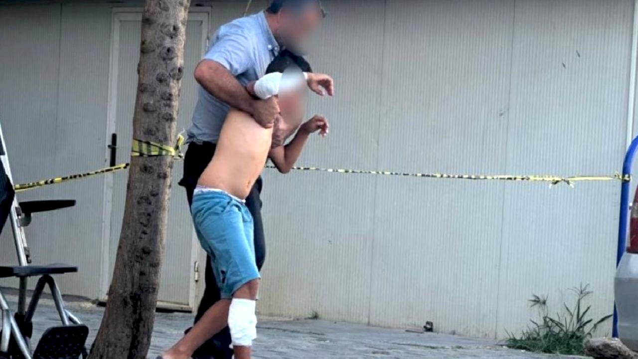 Adıyaman&#039;da başıboş köpek, çocuğa saldırdı