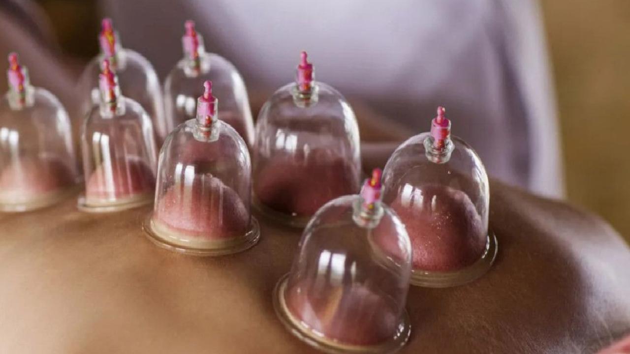 2025'in son hacamat günleri: Aralık ayı sünnetli hacamat takvimi