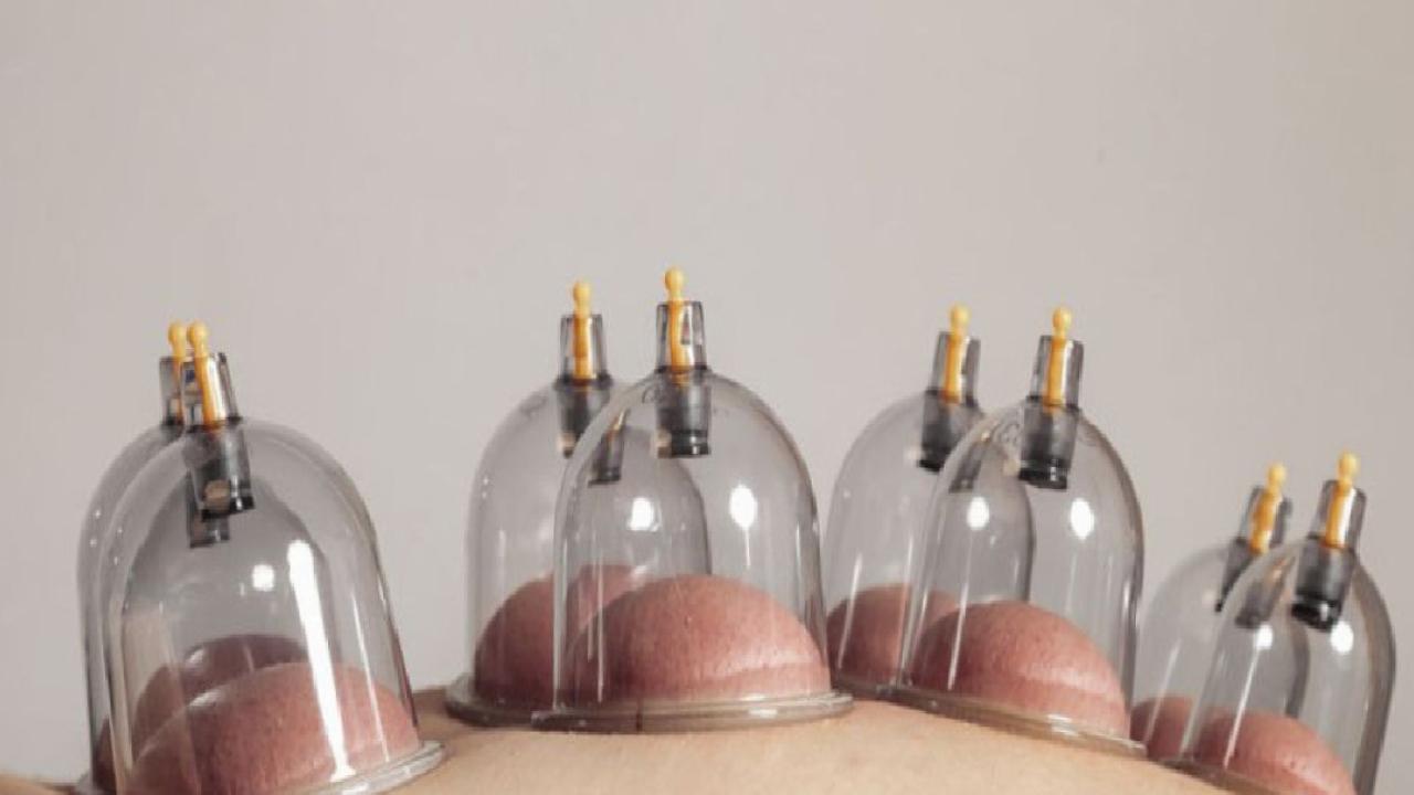 2025'in son hacamat günleri: Aralık ayı sünnetli hacamat takvimi