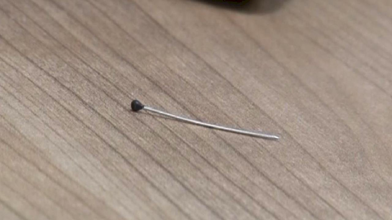 İstanbul&#039;da 2 yaşındandaki bebeğin bağırsağından iğne çıktı