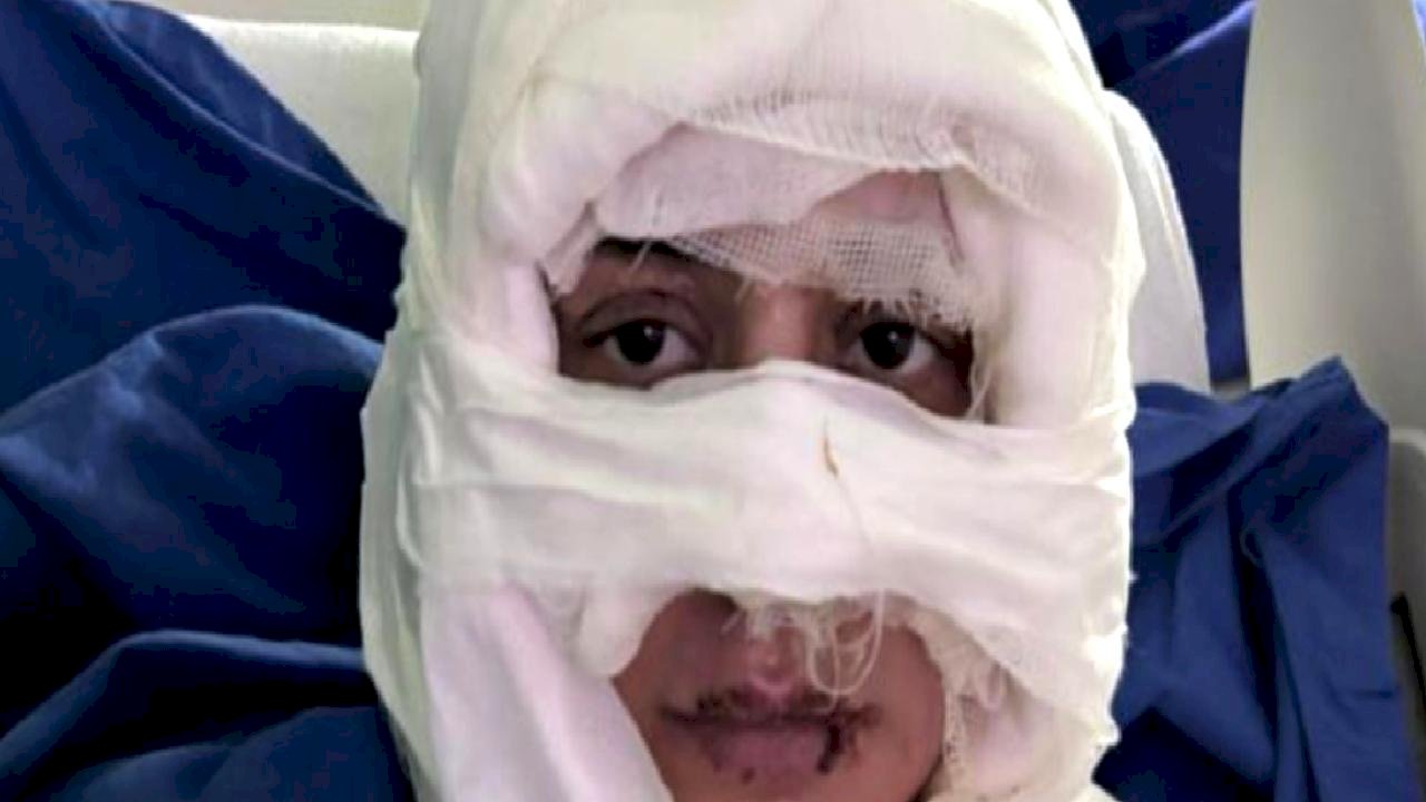 Kadıköy'de genç kadın, başka bir kadın tarafından ateşe verildi