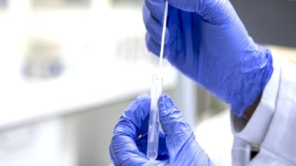 Kuzey Yarımküre'de H3N2 alarmı: Virüs çok hızlı yayılıyor