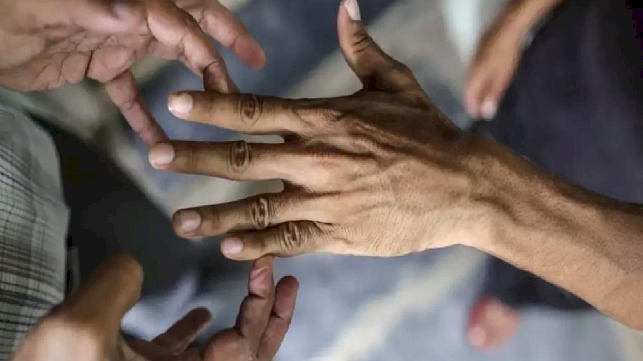 44 yıl sonra bir ilk! 2 ülkede cüzzam vakaları görülmeye başladı