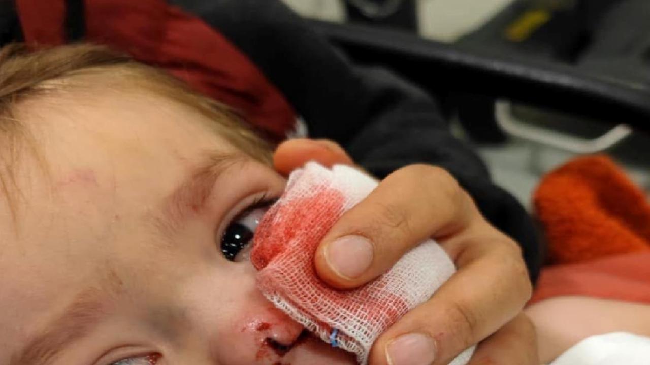 Ankara'da iki çocuğu yaralayan pitbull ve sahibi yakalandı