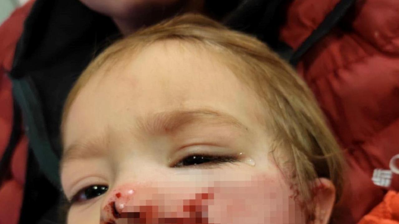 Ankara'da iki çocuğu yaralayan pitbull ve sahibi yakalandı