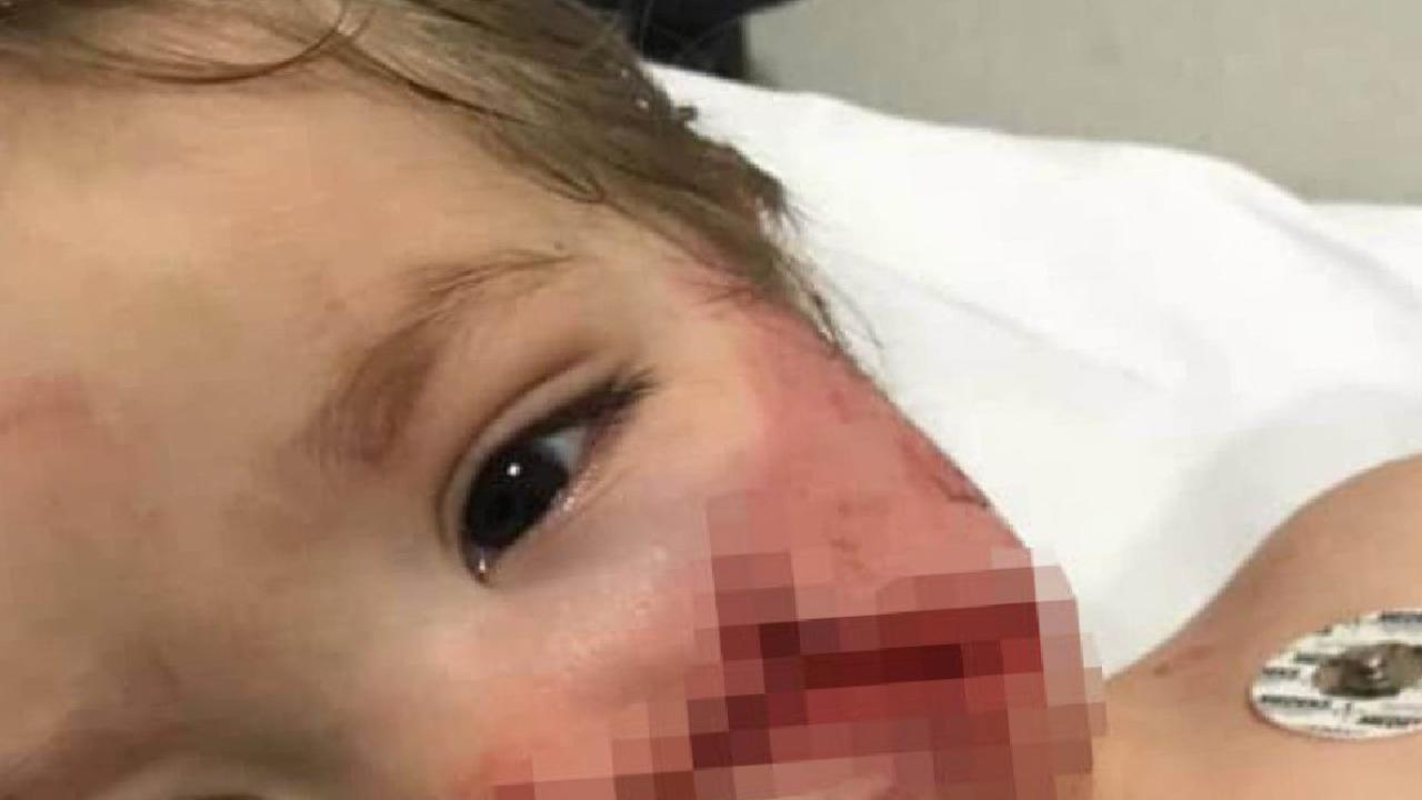 Ankara'da iki çocuğu yaralayan pitbull ve sahibi yakalandı