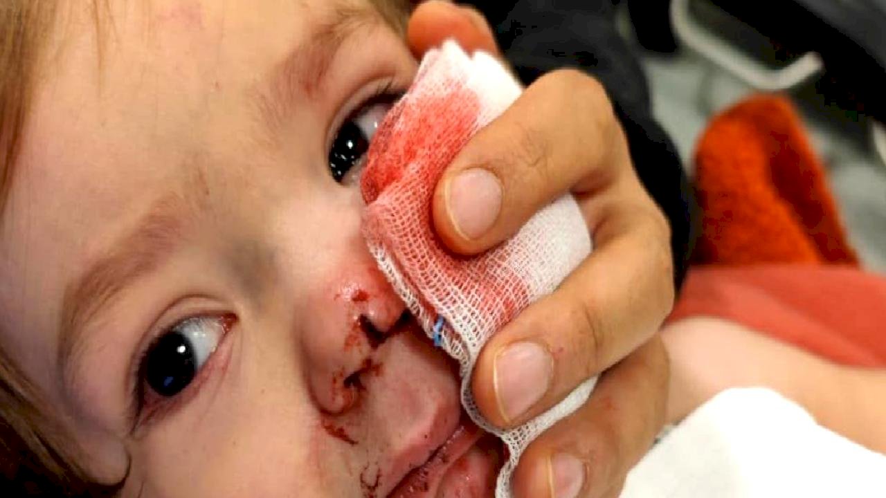 Ankara'da iki çocuğu yaralayan pitbull ve sahibi yakalandı