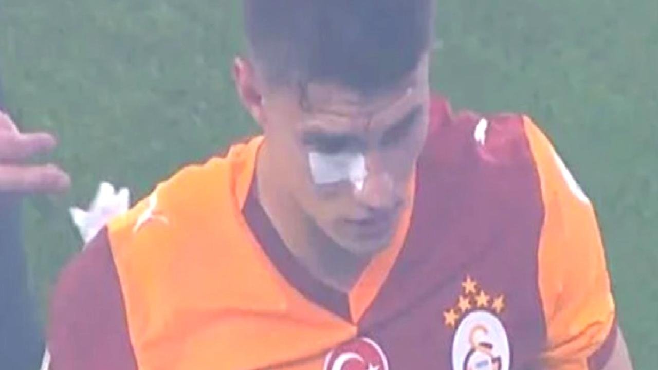 Kazımcan Karataş'a derbide yabancı madde geldi!