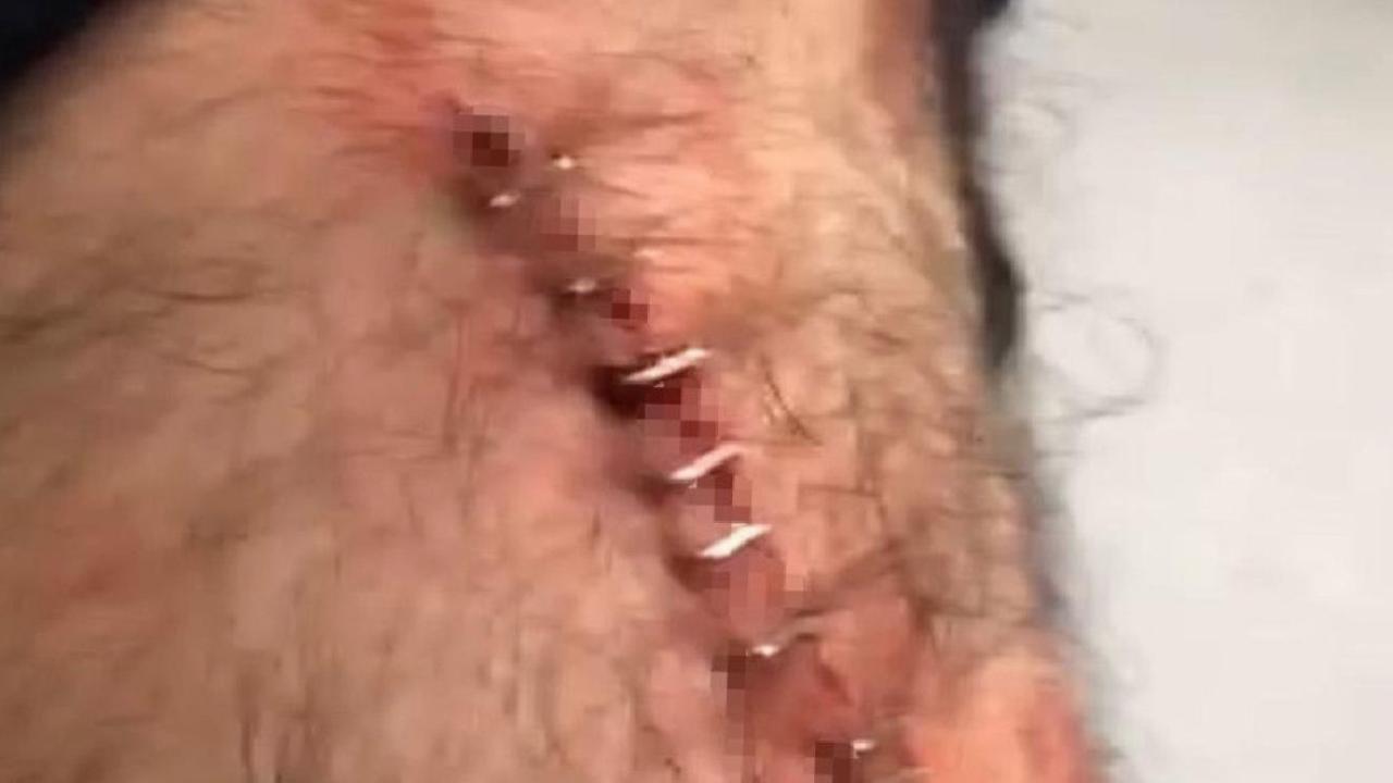 Şanlıurfa'da görev yapan öğretmene sokak ortasında jiletli saldırı