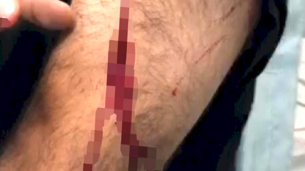 Şanlıurfa'da görev yapan öğretmene sokak ortasında jiletli saldırı