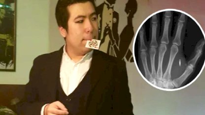 ABD’de moleküler biyolog, eline yerleştirdiği mikroçipin şifresini unuttu