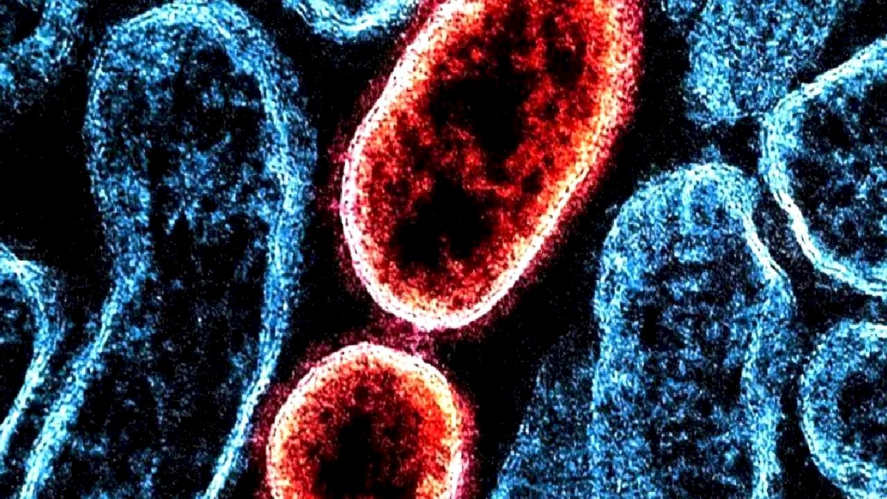 Hindistan'da Nipah Virüsü Salgını