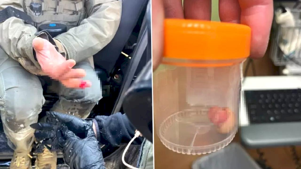 ICE karşıtı protestolarda şoke eden olay: Görevlinin parmağını ısırarak kopardılar