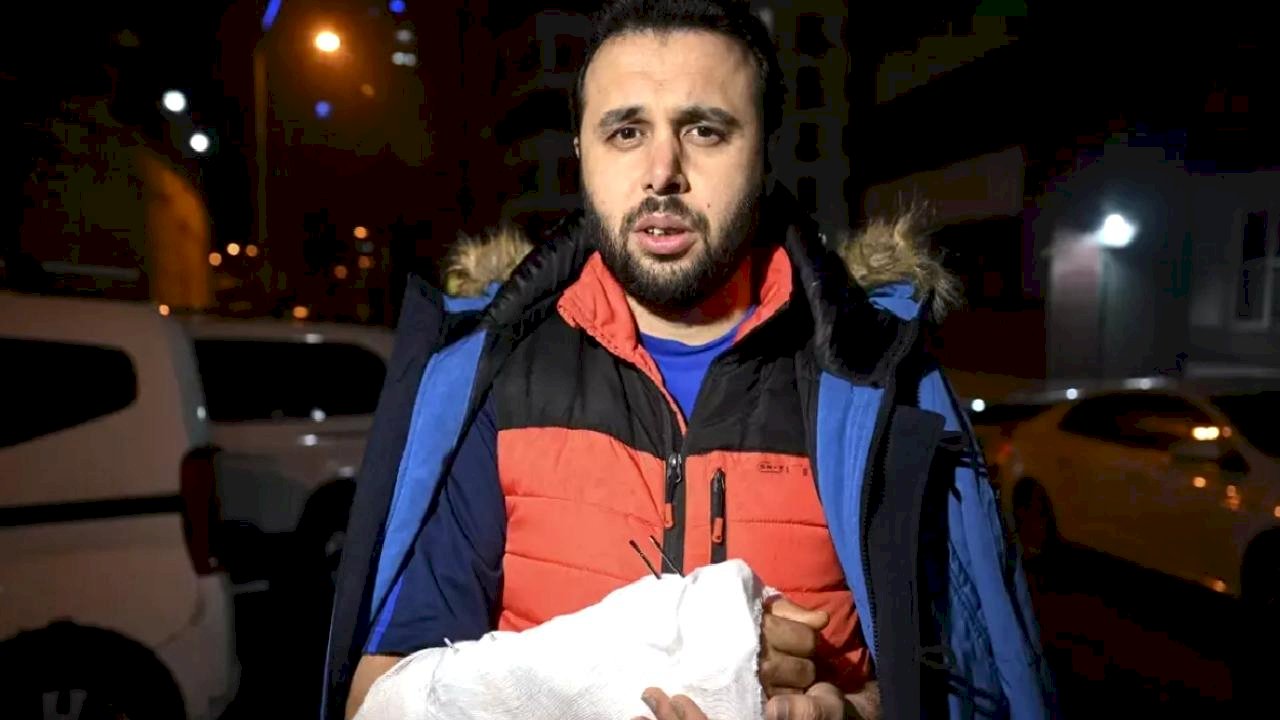 Mamak'ta Köpek Saldırısında Kolunu Kırdı