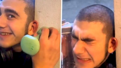 Dövüşçülere benzemek için kulak kıkırdaklarını kırdırdı